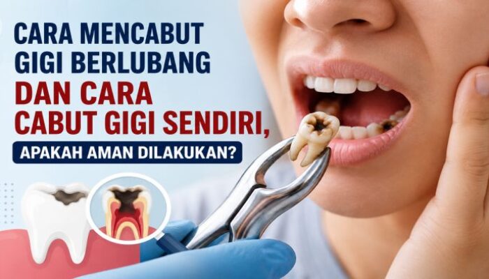 Cara Mencabut Gigi Berlubang dan Cara Cabut Gigi Sendiri, Apakah Aman Dilakukan?